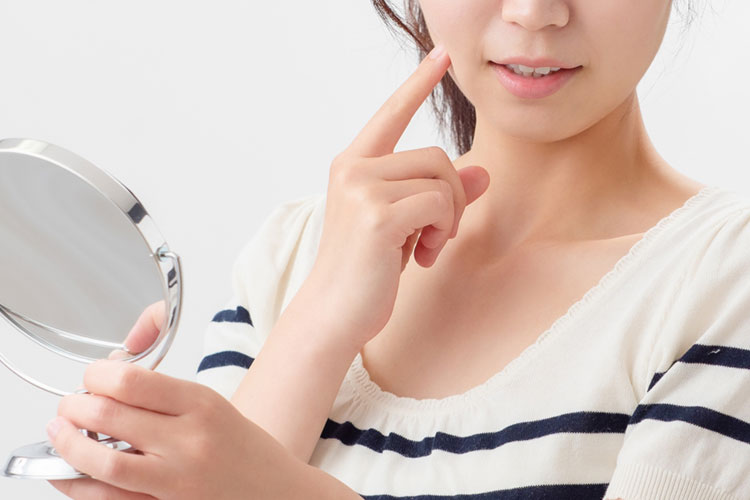 にきびのイメージ画像
